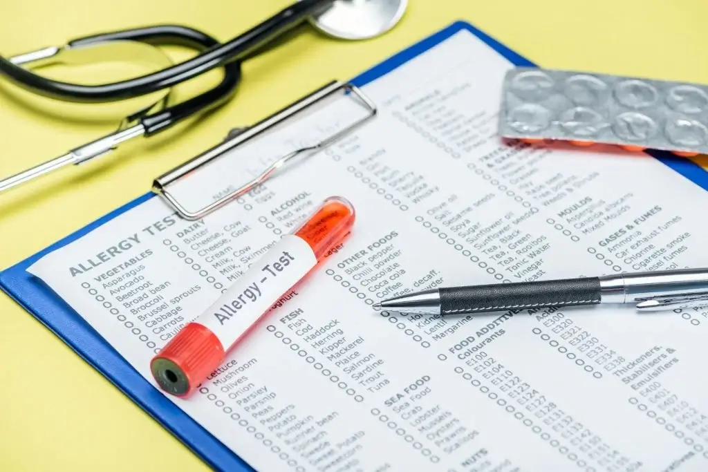 test tube and pen on allergy test results near stethoscope on yellow 1024x683 1